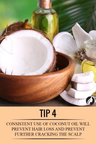 10 Ways to Use Coconut Oil to Prevent Hair Loss