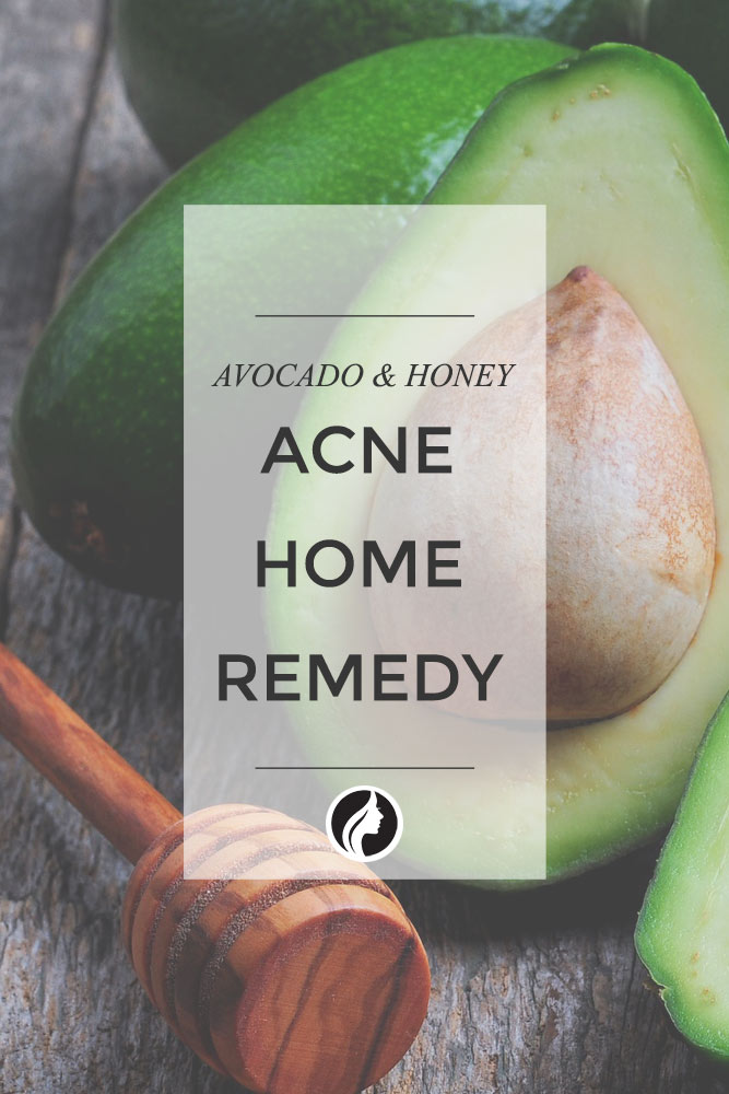 14 Easy Home Acne Remedies For Beautiful Skin