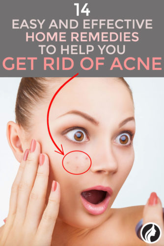 14 Easy Home Acne Remedies for Beautiful Skin