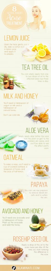 Best Natural Remedies for Acne Treatment