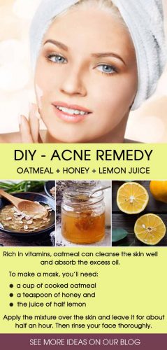 Best Natural Remedies for Acne Treatment