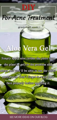 Aloe For Acne Treatment