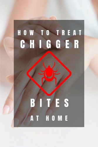 Treatment Chigger Bites #health #chiggers