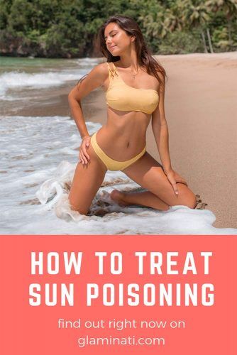 How To Treat Sun Poisoning #summer #skinprotect #health