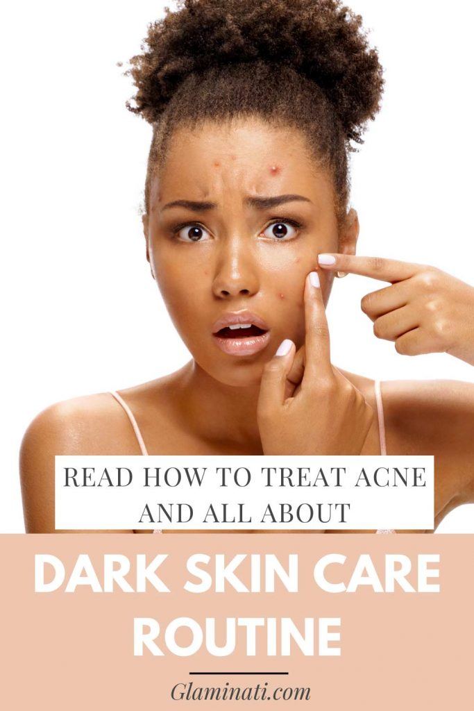 Acne Treatment is Important