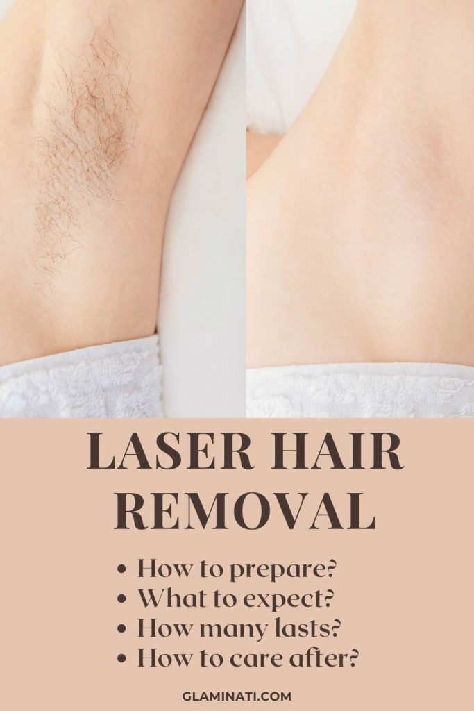 What is Laser Hair Removal?