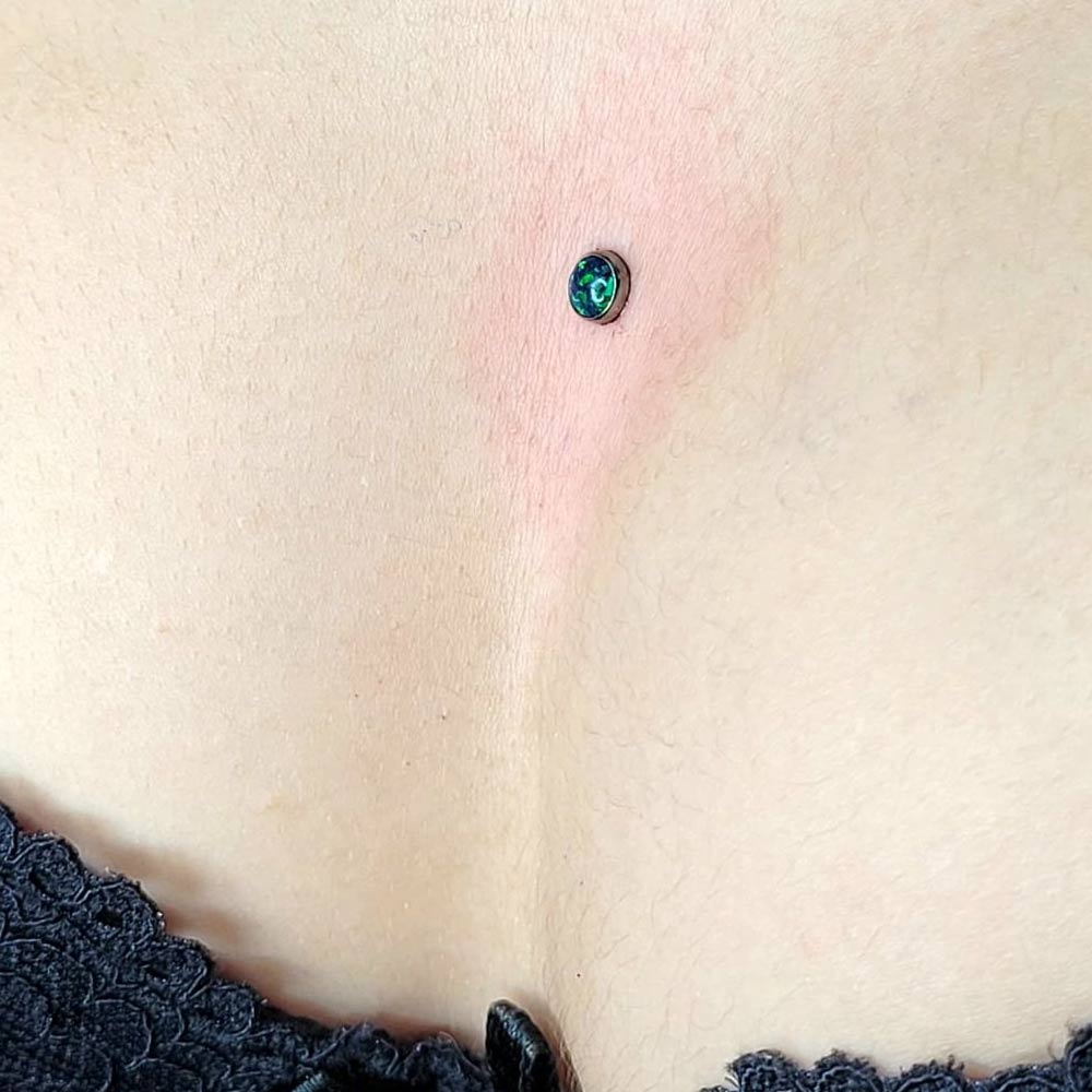 How to Retire the Dermal Piercing