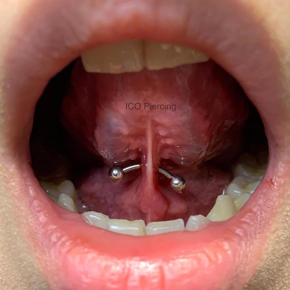 How to Identify and Treat Frenulum Piercing Infection