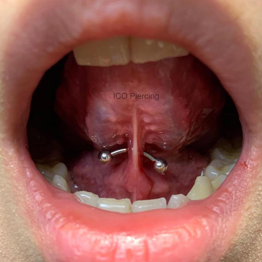 tongue web piercing infection