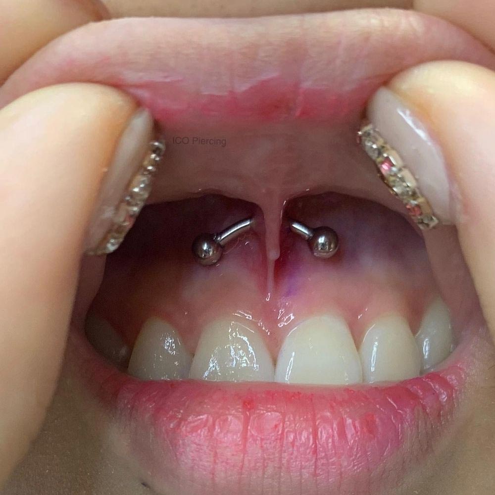 tongue web piercing infection