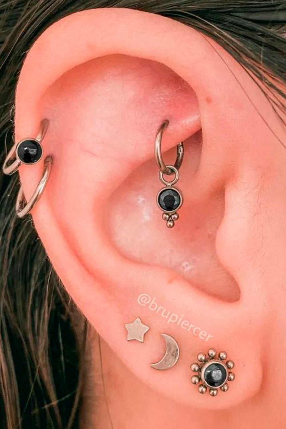 Rook Piercing Procedure.