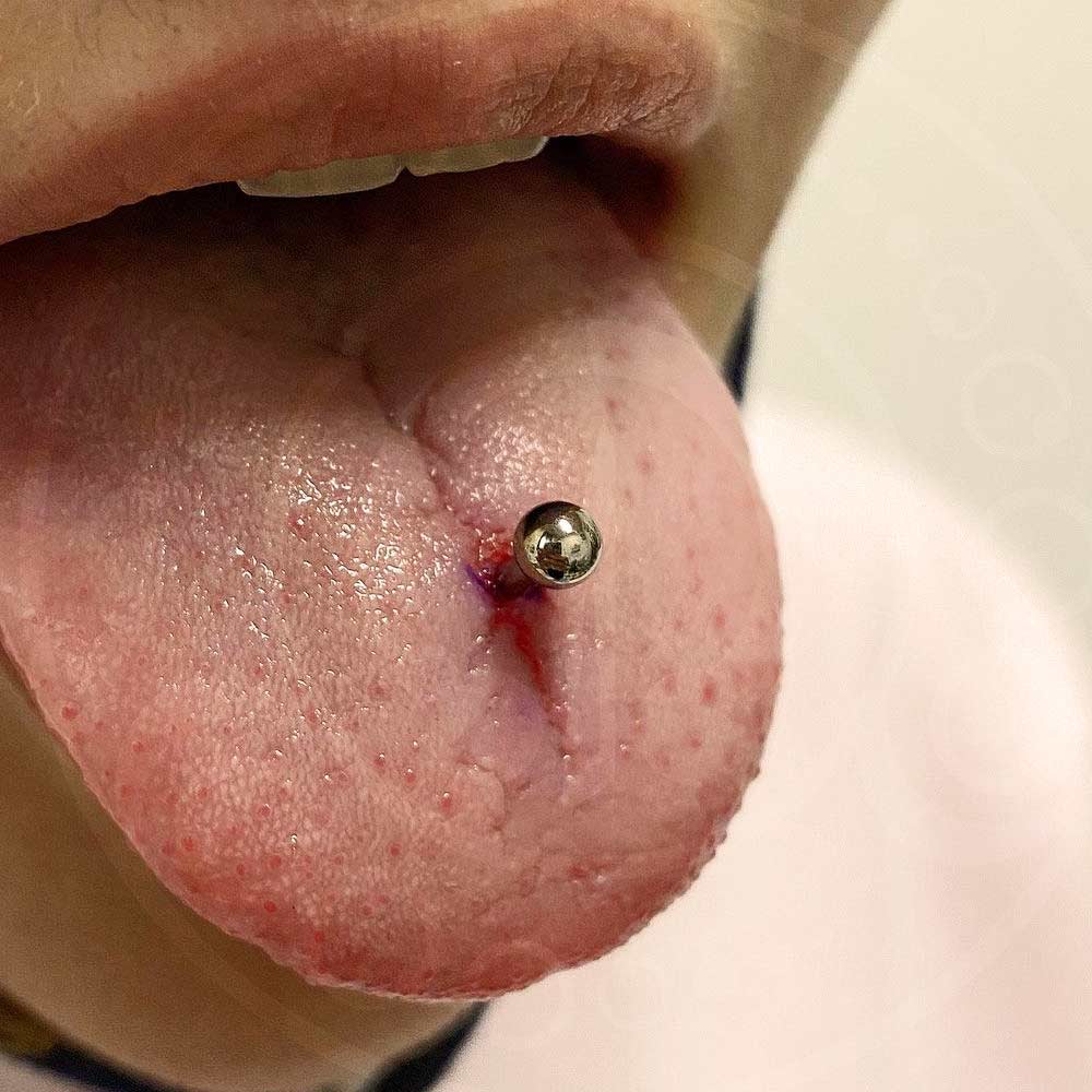 Aftercare for Tongue Piercings
