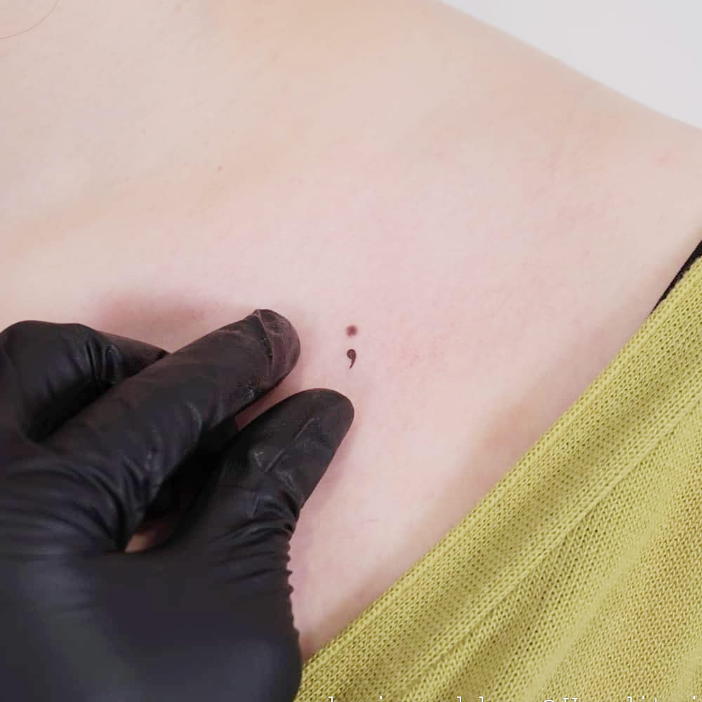 Birthmark Semicolon Tattoo
