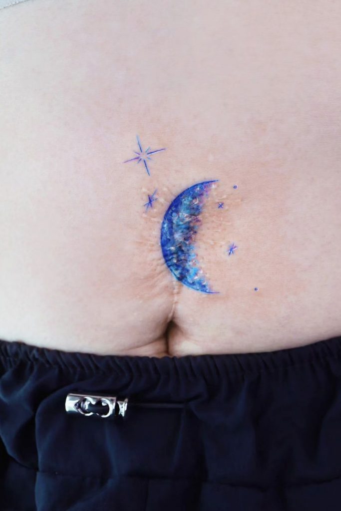 Scar Cover-Up with Moon Design