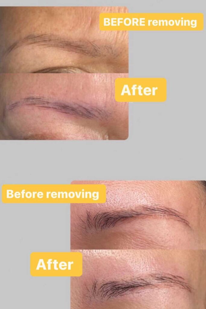 Why Should You Remove Your Old Permanent Makeup?